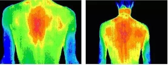热成像在临床诊断方面的作用